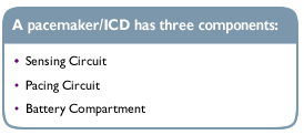 A pacemaker/ICD has three components