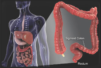 Stool Guaiac Card test for colon cancer