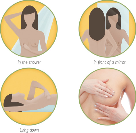 How to Perform a Breast Self-Exam