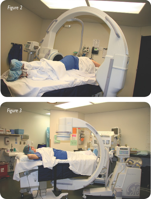 Hip Replacement Figure 2, 3